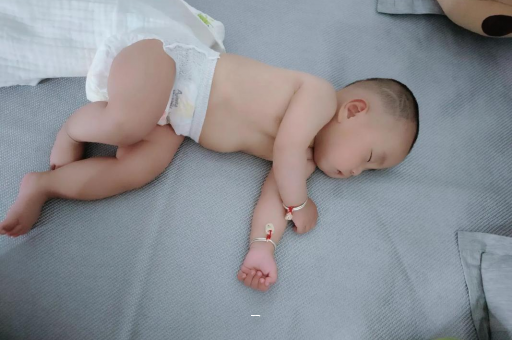 弥勒宝宝脸上有白色斑块